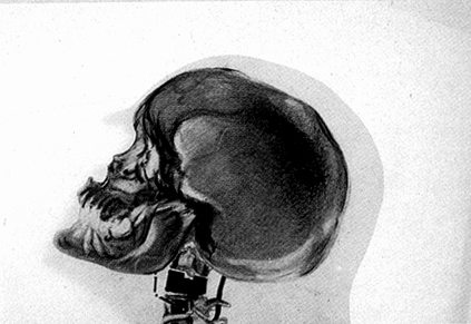 [skull and neck vertebrae]